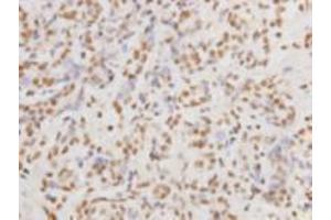 Immunohistochemistry (Paraffin-embedded Sections) (IHC (p)) image for anti-Protein Kinase, DNA-Activated, Catalytic Polypeptide (PRKDC) (Catalytic Subunit) antibody (ABIN1112714) (PRKDC anticorps  (Catalytic Subunit))