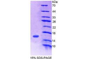 SDS-PAGE analysis of Human FAM132A Protein. (FAM132A Protéine)