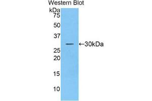 Western Blotting (WB) image for anti-ADAM Metallopeptidase Domain 20 (ADAM20) (AA 367-615) antibody (ABIN1857890) (ADAM20 anticorps  (AA 367-615))