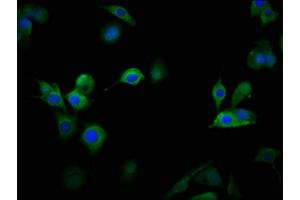 Immunofluorescence staining of MCF-7 cells with ABIN7175590 at 1:100, counter-stained with DAPI. (CACNA1D anticorps  (AA 1691-1806))