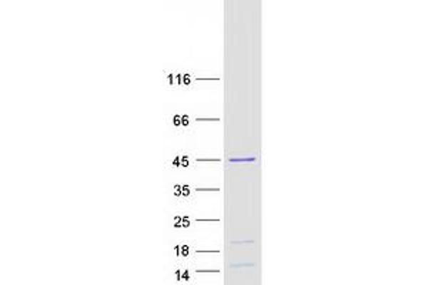 HNRNPD/AUF1 Protein (Transcript Variant 4) (Myc-DYKDDDDK Tag)