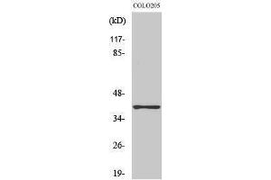 Western Blotting (WB) image for anti-Aldo-Keto Reductase Family 1, Member A1 (Aldehyde Reductase) (AKR1A1) (C-Term) antibody (ABIN3173732) (AKR1A1 anticorps  (C-Term))