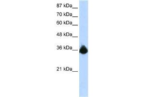 WB Suggested Anti-PTBP2 Antibody Titration:  1. (PTBP2 anticorps  (N-Term))