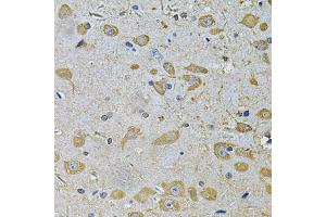 Immunohistochemistry of paraffin-embedded rat brain using DAAM2 Antibody (ABIN5975551) at dilution of 1/100 (40x lens). (DAAM2 anticorps)