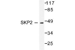 Image no. 1 for anti-S-Phase Kinase-Associated Protein 2 (SKP2) antibody (ABIN271816) (SKP2 anticorps)