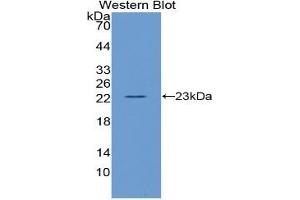 Western Blotting (WB) image for Interleukin 10 (IL10) ELISA Kit (ABIN6574130)