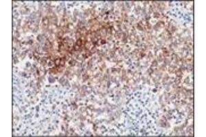 Immunohistochemistry (IHC) image for anti-Placental Alkaline Phosphatase (ALPP) antibody (ABIN870414) (PLAP anticorps)