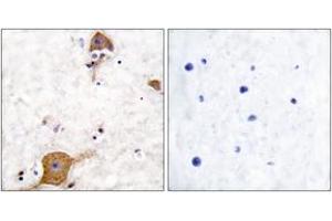 Immunohistochemistry analysis of paraffin-embedded human brain tissue, using NRG1 isoform-10 Antibody. (NRG1 Isoform-10 (AA 1-50) anticorps)