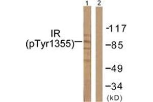 Western blot analysis of extracts from 293 cells treated with Heat shock, using IR (Phospho-Tyr1355) Antibody. (IR (AA 1326-1375), (pTyr1355) anticorps)