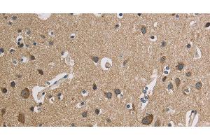 Immunohistochemistry of paraffin-embedded Human brain using CYCS Polyclonal Antibody at dilution of 1:50 (Cytochrome C anticorps)