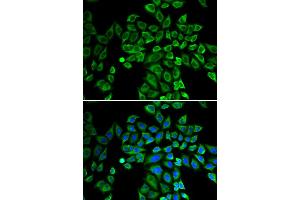 Immunofluorescence analysis of HeLa cell using ANGPT2 antibody. (Angiopoietin 2 anticorps)