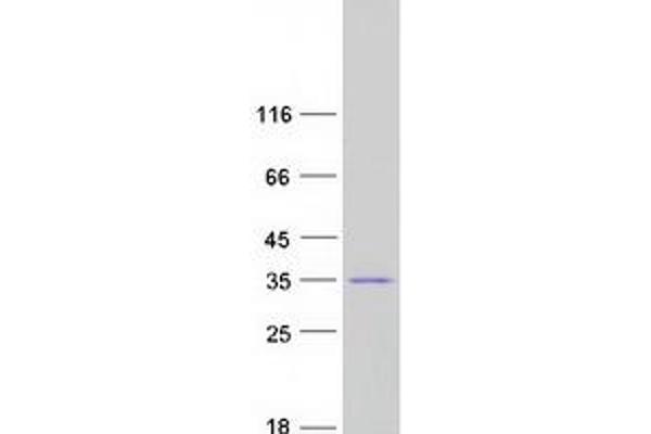 CHMP2B Protein (Myc-DYKDDDDK Tag)