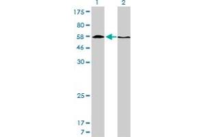 Western Blotting (WB) image for anti-Histone Deacetylase 1 (HDAC1) (AA 1-482) antibody (ABIN516392)