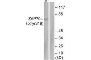 Western blot analysis of extracts from Jurkat cells, using ZAP-70 (Phospho-Tyr319) Antibody. (ZAP70 anticorps  (pTyr319))