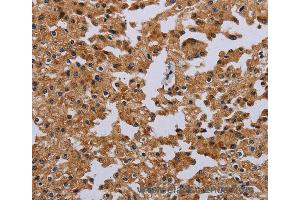 Immunohistochemistry of Human brain  using IFRD1 Polyclonal Antibody at dilution of 1:40 (IFRD1 anticorps)
