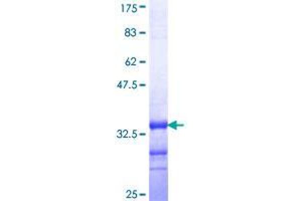 TMIE Protein (AA 79-140) (GST tag)