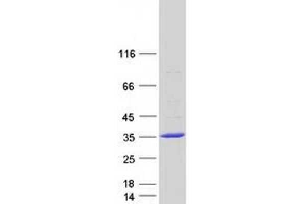 FAM109B Protein (Myc-DYKDDDDK Tag)