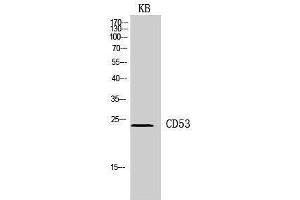 Western Blotting (WB) image for anti-CD53 (CD53) (Internal Region) antibody (ABIN3178937) (CD53 anticorps  (Internal Region))