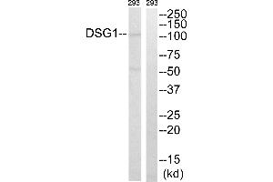 Western blot analysis of extracts from 293 cells, using DSG1 antibody. (Desmoglein 1 anticorps  (Internal Region))