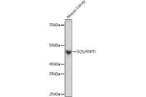 Western blot analysis of extracts of Mouse kidney, using SQS/FDFT1 Rabbit mAb (ABIN7267130) at 1:1000 dilution. (FDFT1 anticorps)
