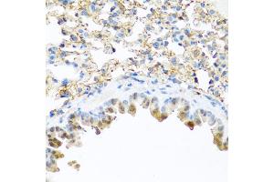 Immunohistochemistry of paraffin-embedded mouse lung using PI3 antibody (ABIN5974984) at dilution of 1/100 (40x lens). (PI3 anticorps)