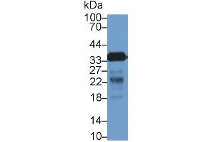 Detection of CD40L in Rat Lymph node lysate using Polyclonal Antibody to Cluster Of Differentiation 40 Ligand (CD40L) (CD40 Ligand anticorps  (AA 48-244))
