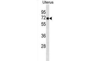 Western Blotting (WB) image for anti-tRNA Methyltransferase 1 (TRMT1) antibody (ABIN3000964) (TRMT1 anticorps)