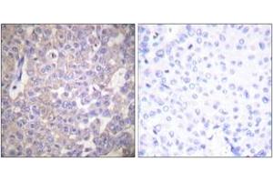 Immunohistochemistry (IHC) image for anti-Claudin 2 (CLDN2) (AA 181-230) antibody (ABIN2889174) (Claudin 2 anticorps  (AA 181-230))