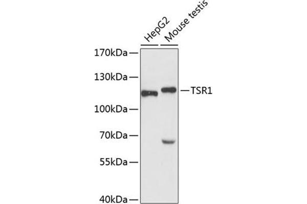 TSR1 anticorps  (AA 455-804)