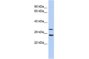 WB Suggested Anti-BIRC7 Antibody Titration:  0. (BIRC7 anticorps  (Middle Region))