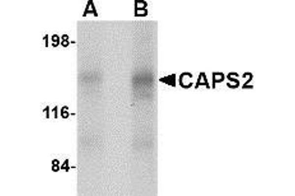 CADPS2 anticorps  (Center)