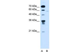 Western Blotting (WB) image for anti-Flavin Containing Monooxygenase 3 (FMO3) antibody (ABIN2462820) (FMO3 anticorps)