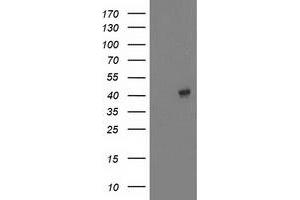 HEK293T cells were transfected with the pCMV6-ENTRY control (Left lane) or pCMV6-ENTRY MAPRE2 (Right lane) cDNA for 48 hrs and lysed. (MAPRE2 anticorps)