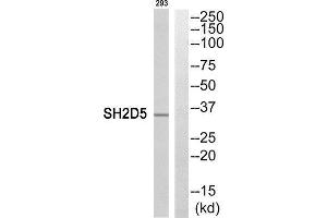 Western Blotting (WB) image for anti-SH2 Domain Containing 5 (SH2D5) (C-Term) antibody (ABIN1852147) (SH2D5 anticorps  (C-Term))
