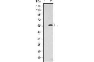 Western Blotting (WB) image for anti-SMAD, Mothers Against DPP Homolog 2 (SMAD2) antibody (ABIN969401)