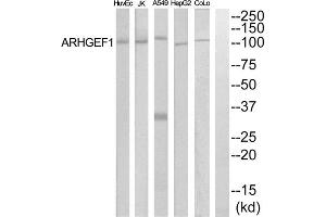 Western blot analysis of extracts from COLO205, HepG2, HuvEc and Jurkat cells, using ARHGEF1 antibody. (ARHGEF1 anticorps  (Internal Region))