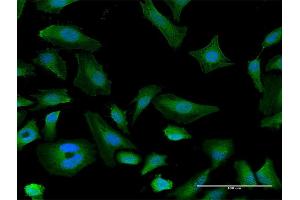 Immunofluorescence of purified MaxPab antibody to ITGAX on HeLa cell. (CD11c anticorps  (AA 1-1169))