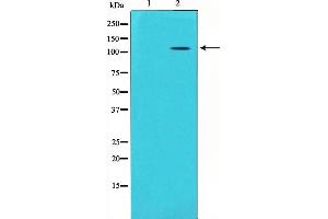 Western blot analysis on mouse brain lysate using GluR5 Antibody,The lane on the left is treated with the antigen-specific peptide. (GRIK1 anticorps  (Internal Region))