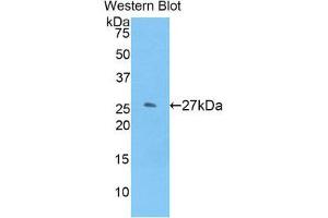 Western Blotting (WB) image for anti-Glutathione S-Transferase mu 1 (GSTM1) (AA 1-218) antibody (ABIN1859091) (GSTM1 anticorps  (AA 1-218))