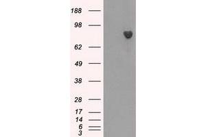 Western Blotting (WB) image for anti-Bruton Agammaglobulinemia tyrosine Kinase (BTK) antibody (ABIN1496973) (BTK anticorps)