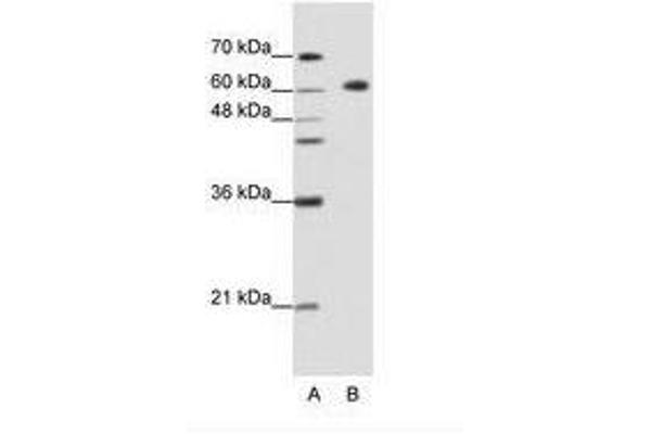 GMEB2 anticorps  (C-Term)