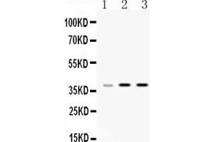 Western blot analysis of HnRNP A1 expression in rat liver extract ( Lane 1), mouse thymus extract ( Lane 2) and HELA whole cell lysates ( Lane 3). (HNRNPA1 anticorps  (N-Term))