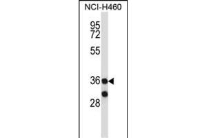RCH11 Antibody (C-term) (ABIN657732 and ABIN2846717) western blot analysis in NCI- cell line lysates (35 μg/lane). (MARCH11 anticorps  (C-Term))