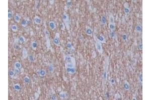 Detection of GHRH in Human Cerebrum Tissue using Monoclonal Antibody to Growth Hormone Releasing Hormone (GHRH) (GHRH anticorps  (AA 19-108))