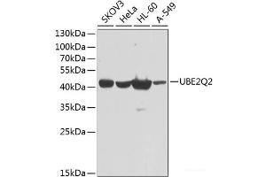 Western blot analysis of extracts of various cell lines using UBE2Q2 Polyclonal Antibody at dilution of 1:1000. (UBE2Q2 anticorps)