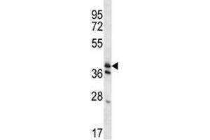 KLF2 antibody western blot analysis in mouse heart tissue lysate. (KLF2 anticorps  (AA 13-42))