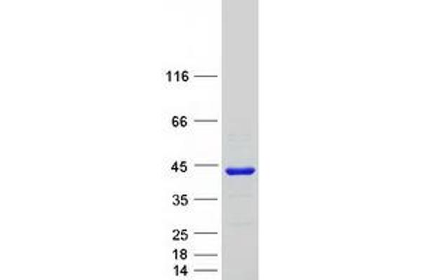 Phosducin-Like Protein (PDCL) (Myc-DYKDDDDK Tag)