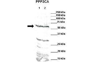 WB Suggested Anti-PPP3CA Antibody    Positive Control:  Lane 1: 80ug mouse brain extractLane 2: 80ug rat brain extract  Primary Antibody Dilution :   1:500  Secondary Antibody :  IRDye 800 CW goat anti-rabbit from Li-COR Bioscience  Secondry Antibody Dilution :   1:20,000  Submitted by:  Dr. (PPP3CA anticorps  (N-Term))