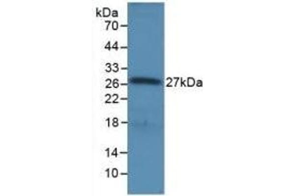 RNASEL anticorps  (AA 358-583)