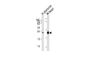 Western blot analysis of lysates from human placenta and heart tissue lysates (from left to right), using FRAT2 Antibody at 1:1000 at each lane. (FRAT2 anticorps  (C-Term))